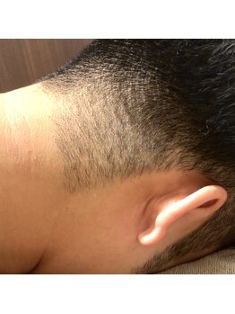 ミーエイト(Mii∞)/《施術終了》