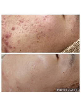 ビラ ベルダ(Bira Beldad)/