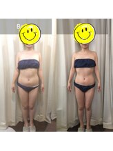 クリニカルエステ(Salon de LOMA reve beaute)/痩身ハイパーナイフ