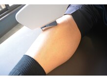 ノーブル(NOBLE)/全身脱毛（足）　施術（１）