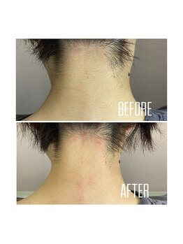 ホワイトワックス 京都四条烏丸(WHITE WAX)/うなじワックス