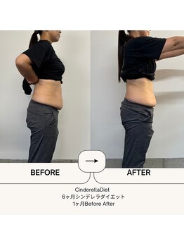 オーシャン整骨院(OCEAN整骨院)/6ヶ月コース