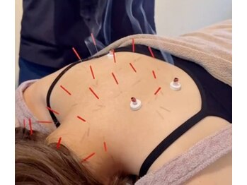 ワタナベ鍼灸整体院の写真/妊活サポートならお任せください♪自律神経を整え、女性特有のお悩みや妊活・マタニティライフをサポート☆