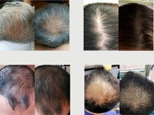 ルリアン(LeLien)の雰囲気（年齢と共に気になる頭皮や白髪、対策をしてまいりましょう）