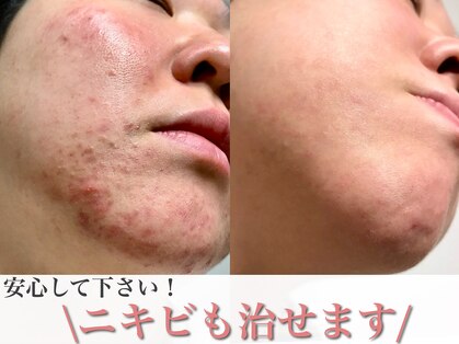 エミナル(eminal)の写真