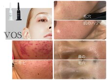 エルール トータルビューティ(Aileure total beauty)