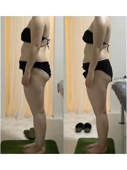 ウル(Ulu)/腸もみビフォーアフター