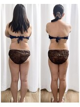 ミロク(369)/脂肪に徹底アプローチ