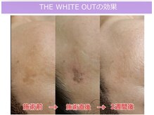 エステ ルーナ 学園前の雰囲気（【シミケア２ミリ５個￥4400-/15分し放題お試し￥7700】）