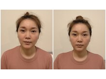 ソル(sol)の雰囲気（本格小顔矯正★姿勢まできれいになる♪）