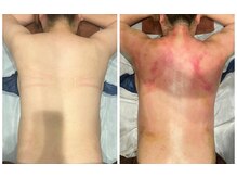 スピード美人 横浜店/BeforeAfter１