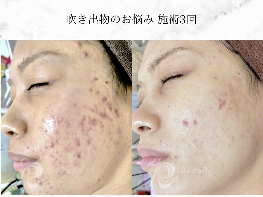 クリーンアンドビューティ 札幌(Clean&Beauty)｜ホットペッパー