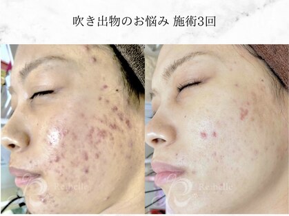 クリーンアンドビューティ 札幌(Clean&Beauty)の写真