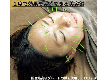のなか鍼灸院の写真