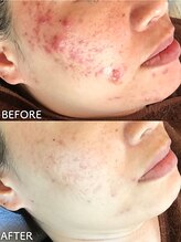 ビアンカ/お客様のお声