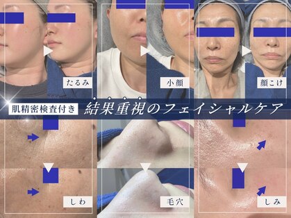 bou 新宿の写真
