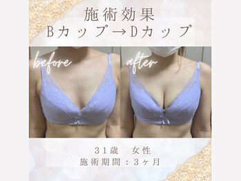 ハリスタ 六本木院(HARISTA)
