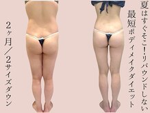 シェリートーキョー 成田店(Cherie Tokyo)