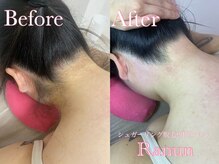 ラナン(Ranun)/デート前にも！即効美人完成