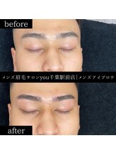 ユー 千葉駅前店(you)/ビフォ－アフター写真