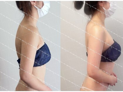 シンビューティーサロン 大宮本店の写真