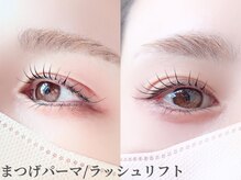 アイシック 勝どき(eyechic)