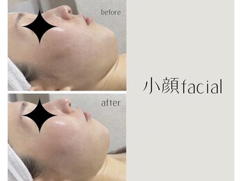 アールエスト(R EST.)の写真/顔筋にアプローチ☆心地良いハンドマッサージで小顔&リフトアップ↑首、肩、デコルテも同時にケア☆