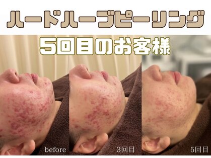 アイル 仙台店(iru)の写真