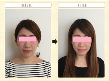 美容整体ウェリナ あま甚目寺院/小顔矯正/骨盤矯正/美脚サロン