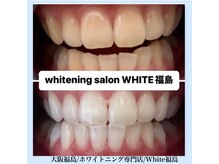 ホワイトニングサロン ホワイト(WHITE)/セルフホワイトニング/大阪/福島