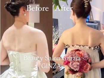 グラツィア 銀座(Grazia)/8回【 ブライダルエステ整体 】