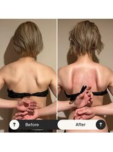 リルーチェ(Reluce)/Before After