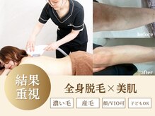 ミスティア(mistia)の雰囲気（痛み・熱さが少ない☆１度の照射で効果を実感♪HIPL美肌脱毛◎）