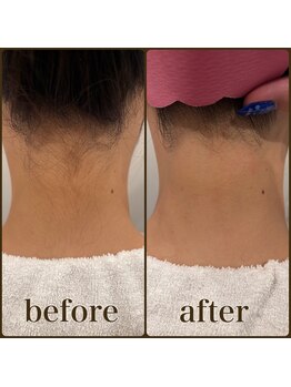 ファビー(Fabby)/うなじシェービング