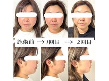ヘアファッション ユミ(HAIR FASHION YUMI)の雰囲気（ポテンツァ導入機使用【レモンボトル導入】初回限定¥7,700!）