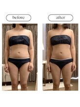 スラン(Slan)/ビフォーアフター/3ヶ月