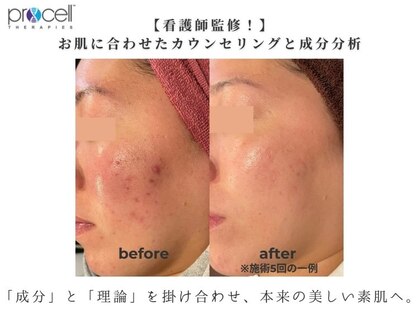 プラージュ(plage)の写真