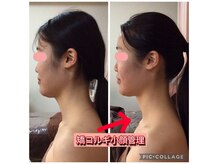 ローズ ド ナチュール(Rose de Nature)の雰囲気（矯コルギ小顔管理3回+小顔ヘッドスパ1回　モニター様）