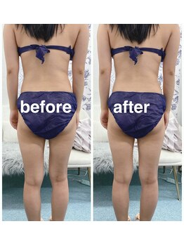 ハロ 南青山(HALO)/脂肪分解スタンプ40PUSH