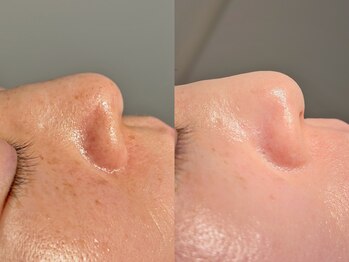 ルーナジェーナ(Luna llena)/池袋/目白/雑司ヶ谷/エステ