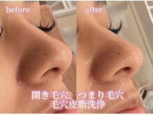 アクトベレッザ(Act BELLEZZA)/開き毛穴解消ララピール