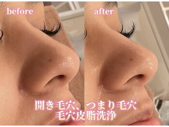 アクトベレッザ(Act BELLEZZA)/開き毛穴解消ララピール