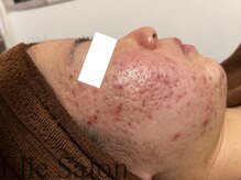 エル(Elle)/before