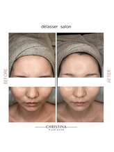 デラッセ(Delasser salon)/美白イラストリアス