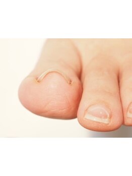 爪の悩みを解消できる（ケア含む）