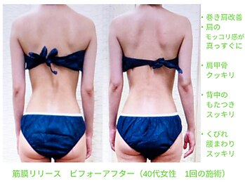 ビューティサロン オハナ(ohana)/筋膜リリースビフォーアフター