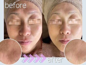 マルサンカクシカク(○△□)/