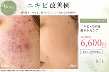 エクラ