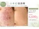 エクラの写真