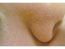 マイボーテヴィラ 関内(my beaute villa)/毛穴集中ケア